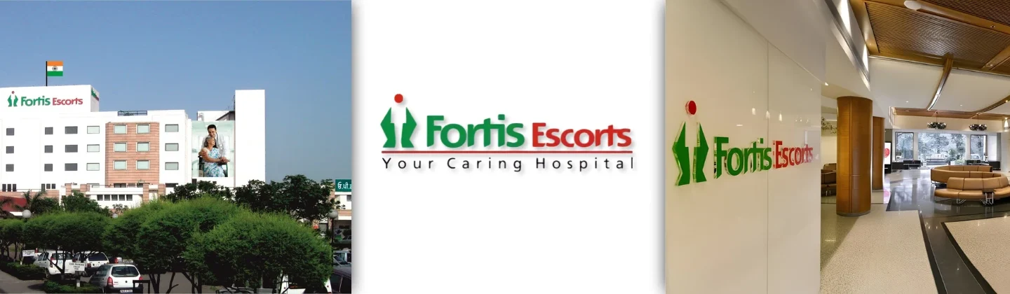 Fortis Escorts